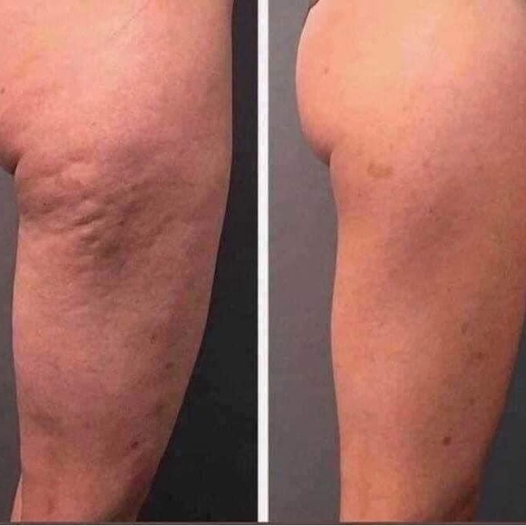 NUSKIN AGELOC HONEY & HIBISCUS CELLULITE LOTION 💋 Lot of 2 tubes - Picture 4 of 7